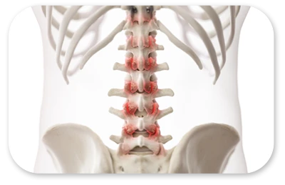 Proliferationstherapie